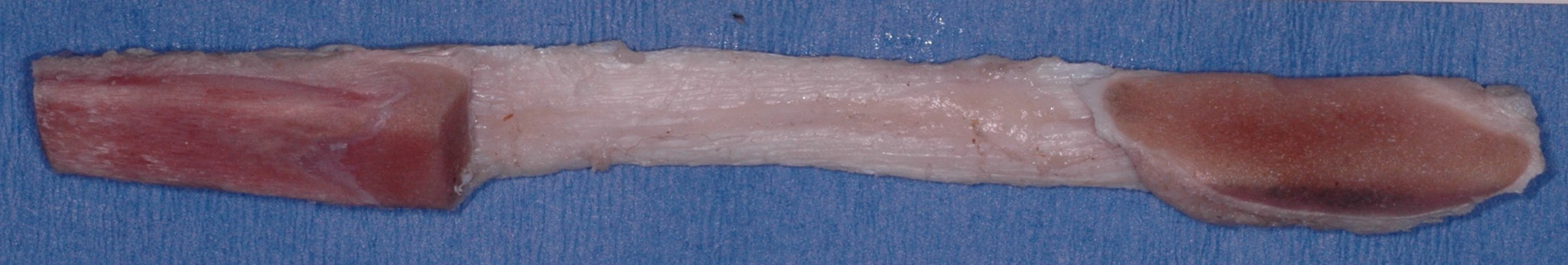 Porcine Bone Tendon Bone Graft